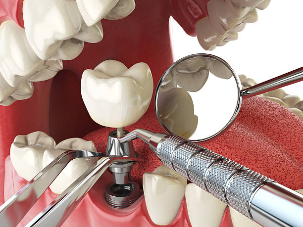 Best Knocked-Out Tooth Emergency  in Milford, OH